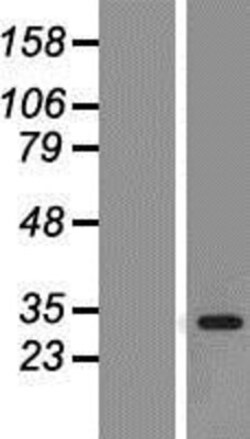 Novus Biologicals&trade;&nbsp;CDK2 Overexpression Lysate