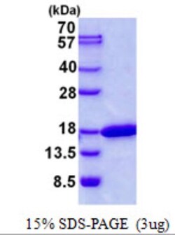 Novus Biologicals&trade;&nbsp;Recombinant Human CDK2AP2 His Protein