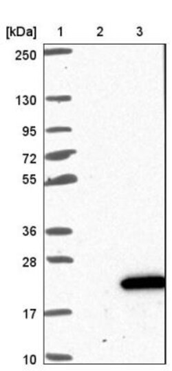 CDK2AP2 Antibody, Novus Biologicals 25 &mu;L, Unconjugated:Antibodies,