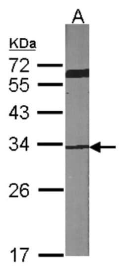 CDK4 Antibody, Novus Biologicals 0.1mg; Unlabeled:Antibodies, Polyclonal