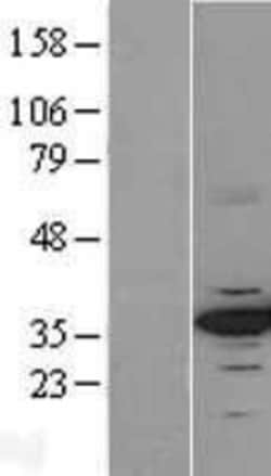 Novus Biologicals&trade;&nbsp;CDK4 Overexpression Lysate