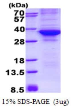 Novus Biologicals&trade;&nbsp;Recombinant Human CDK4 His Protein