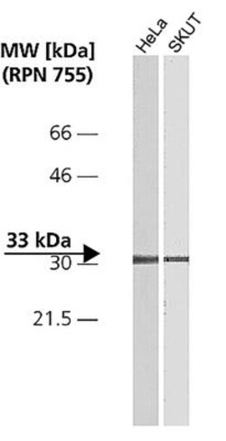 CDK4 Antibody (DCS-31), Novus Biologicals 0.25mL; Unlabeled:Antibodies,