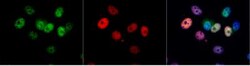 CDK4 Antibody, Novus Biologicals 0.1mg; Unlabeled:Antibodies, Polyclonal