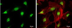 CDK4 Antibody, Novus Biologicals 0.1mg; Unlabeled:Antibodies, Polyclonal