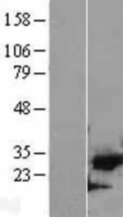 Novus Biologicals™ Cdk5 Overexpression Lysate