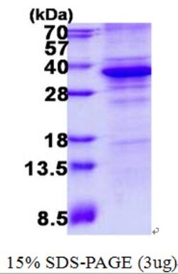 Novus Biologicals&trade;&nbsp;Recombinant Human Cdk5 His Protein