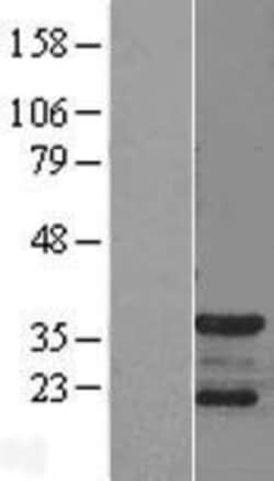Novus Biologicals&trade;&nbsp;CDK5 Activator 1 Overexpression Lysate