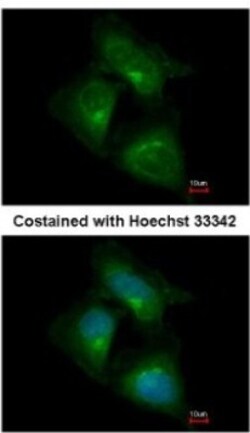 CDK5RAP1 Antibody, Novus Biologicals 0.1mL; Unlabeled:Antibodies, Polyclonal