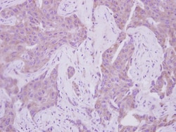 CDK5RAP1 Antibody, Novus Biologicals 0.1mL; Unlabeled:Antibodies, Polyclonal