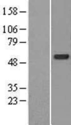 Novus Biologicals™ CDK5RAP3 Overexpression Lysate