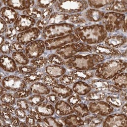 CDK5RAP3 Antibody, Novus Biologicals:Antibodies:Primary Antibodies