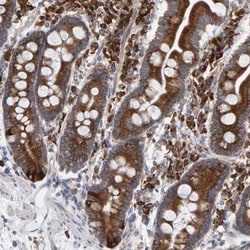 Aminopeptidase B/RNPEP Antibody, Novus Biologicals:Antibodies:Primary Antibodies