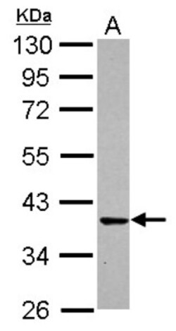 Cdk6 Antibody, Novus Biologicals 0.1 mL | Buy Online | Novus Biologicals | Fisher Scientific