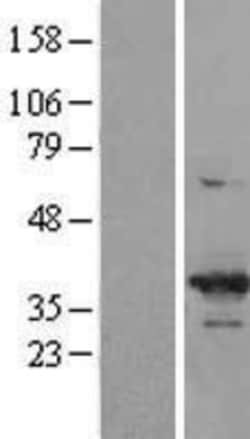Novus Biologicals&trade;&nbsp;Cdk6 Overexpression Lysate