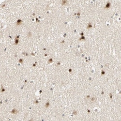 TWEAK R/TNFRSF12 Antibody, Novus Biologicals:Antibodies:Primary Antibodies