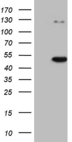 CDKL1 Antibody (OTI1D9), Novus Biologicals 0.1mL; Unlabeled:Antibodies,
