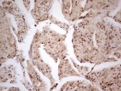 CDKL1 Antibody (OTI1D9), Novus Biologicals 0.1mL; Unlabeled:Antibodies,