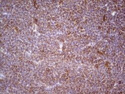 CDKL1 Antibody (OTI1D9), Novus Biologicals 0.1mL; Unlabeled:Antibodies,