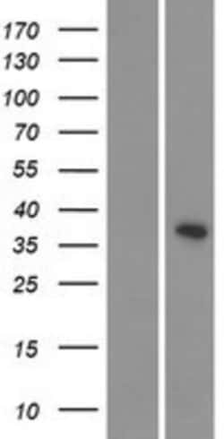 Novus Biologicals&trade;&nbsp;CDKL4 Overexpression Lysate