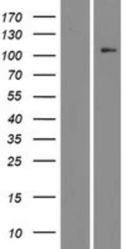 Novus Biologicals&trade;&nbsp;CDKL5 Overexpression Lysate
