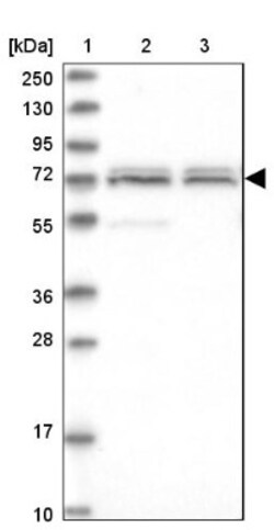 CARF/CDKN2AIP Antibody, Novus Biologicals 0.1mL; Unlabeled:Antibodies,