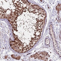 CARF/CDKN2AIP Antibody, Novus Biologicals 0.1mL; Unlabeled:Antibodies,