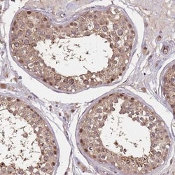 CDKN2A Interacting protein N-Terminal Like Antibody, Novus Biologicals 25ul | Buy Online | Novus Biologicals | Fisher Scientific