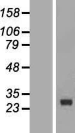 Novus Biologicals&trade;&nbsp;CDKN3 Overexpression Lysate