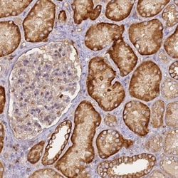 CD-M6PR Antibody, Novus Biologicals 0.1mL; Unlabeled:Antibodies, Polyclonal