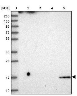 CDNF Antibody, Novus Biologicals:Antibodies:Primary Antibodies