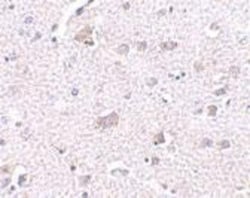 CDNF Antibody - BSA Free, Novus Biologicals 0.1mg; Unlabeled:Antibodies,