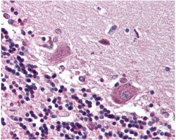 CDR2 Antibody, Novus Biologicals:Antibodies:Primary Antibodies