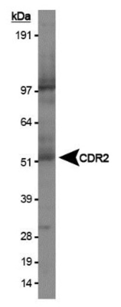 CDR2 Antibody, Novus Biologicals:Antibodies:Primary Antibodies