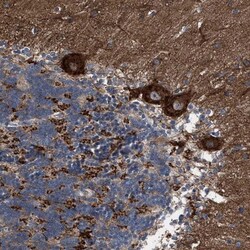 CDR2L Antibody, Novus Biologicals:Antibodies:Primary Antibodies