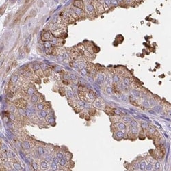CDRT15 Antibody, Novus Biologicals 25 &mu;L, Unlabeled:Antibodies, Polyclonal
