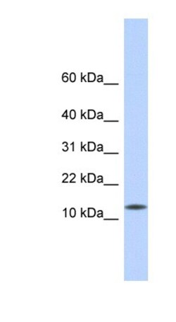 CDRT4 Antibody, Novus Biologicals 100 &mu;L | Buy Online | Novus Biologicals | Fisher Scientific