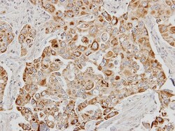 CDS1 Antibody, Novus Biologicals 0.1mg; Unlabeled:Antibodies, Polyclonal