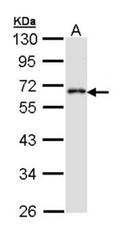 CDS1 Antibody, Novus Biologicals 0.1mg; Unlabeled:Antibodies, Polyclonal