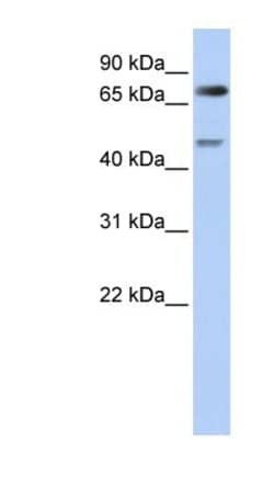 CDT2 Antibody, Novus Biologicals:Antibodies:Primary Antibodies