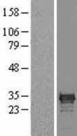 Novus Biologicals&trade;&nbsp;Cdx1 Overexpression Lysate