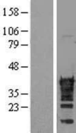 Novus Biologicals&trade;&nbsp;CDX2 Overexpression Lysate