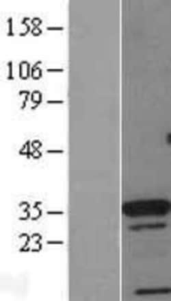 Novus Biologicals™ CDX4 Overexpression Lysate