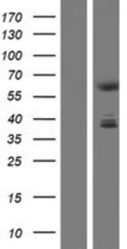 Novus Biologicals™ CDYL Overexpression Lysate