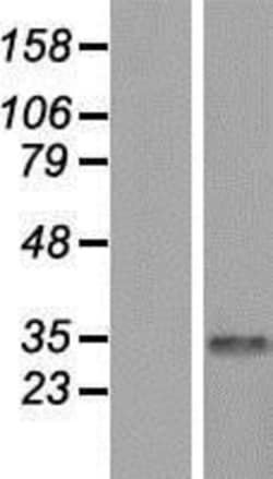 Novus Biologicals&trade;&nbsp;CDYL Overexpression Lysate