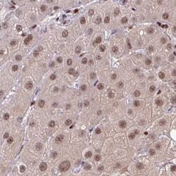 CDYL Antibody, Novus Biologicals 0.1mL; Unlabeled:Antibodies, Polyclonal