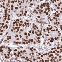 CDYL Antibody, Novus Biologicals 0.1mL; Unlabeled:Antibodies, Polyclonal