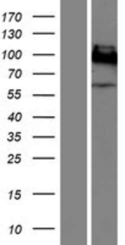 Novus Biologicals&trade;&nbsp;CEACAM1/CD66a Overexpression Lysate
