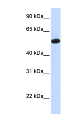 CEACAM16 Antibody, Novus Biologicals:Antibodies:Primary Antibodies