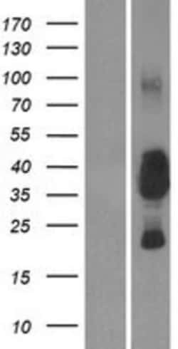 Novus Biologicals&trade;&nbsp;CEACAM19 Overexpression Lysate